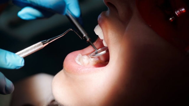 Overview of General Dentistry Definition and Importance