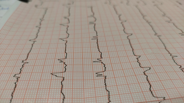 Understanding Cardiovascular Technology